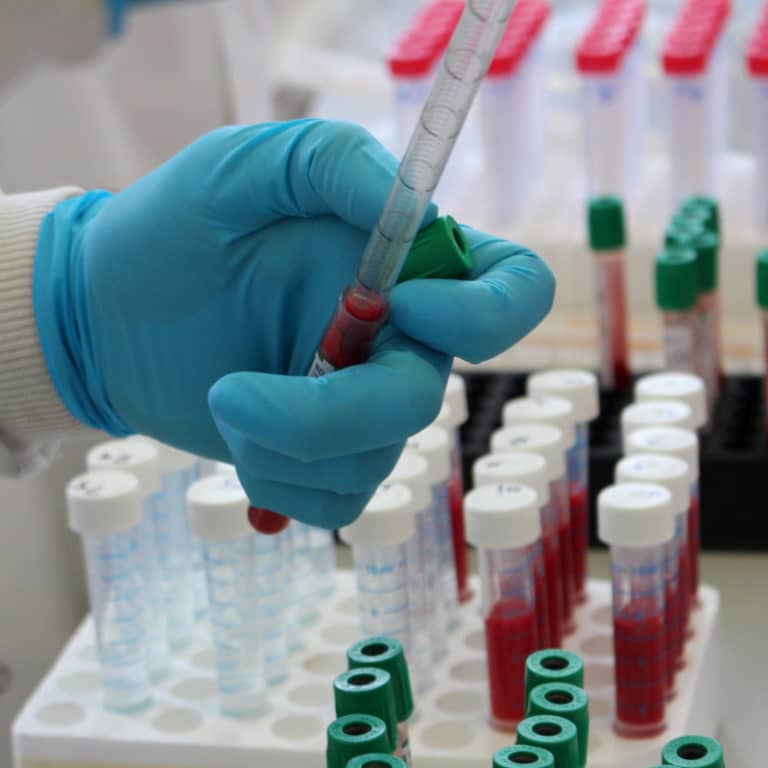 PBD Biotech - blood tests